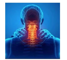 Load image into Gallery viewer, Degenerative Cervical Myelopathy Boot Camp Program (Practitioners) Online Course
