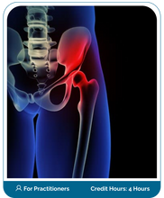 Load image into Gallery viewer, Hip Osteoarthritis Online Boot Camp Program Course (Practitioner)
