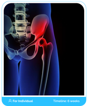 Load image into Gallery viewer, Hip Osteoarthritis Online Boot Camp Program Course (Public)
