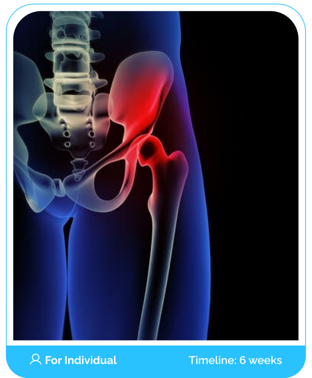 Hip Osteoarthritis Online Boot Camp Program Course (Public)