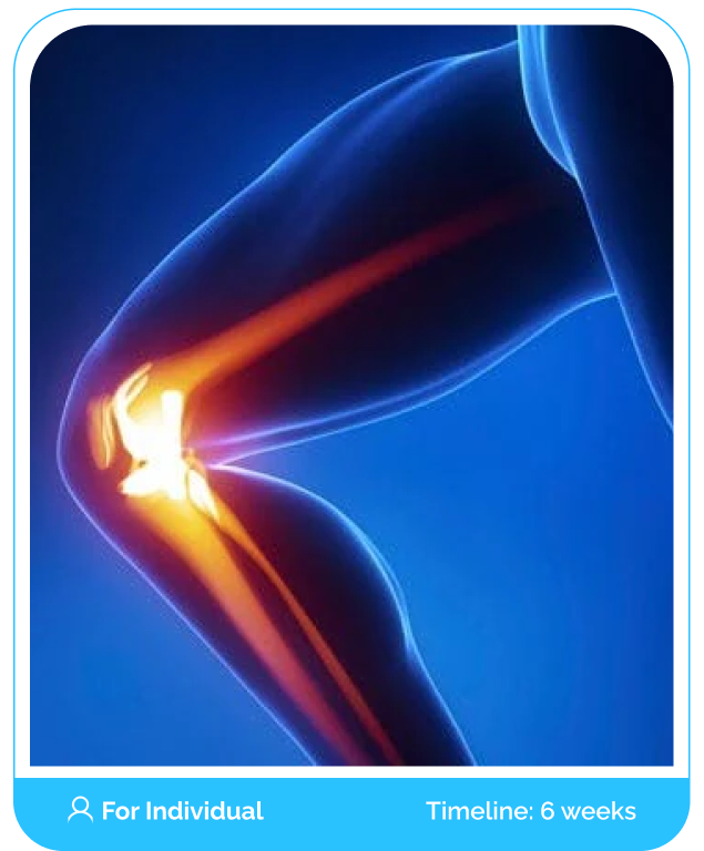 Knee Osteoarthritis Online Boot Camp Program Course (Public)