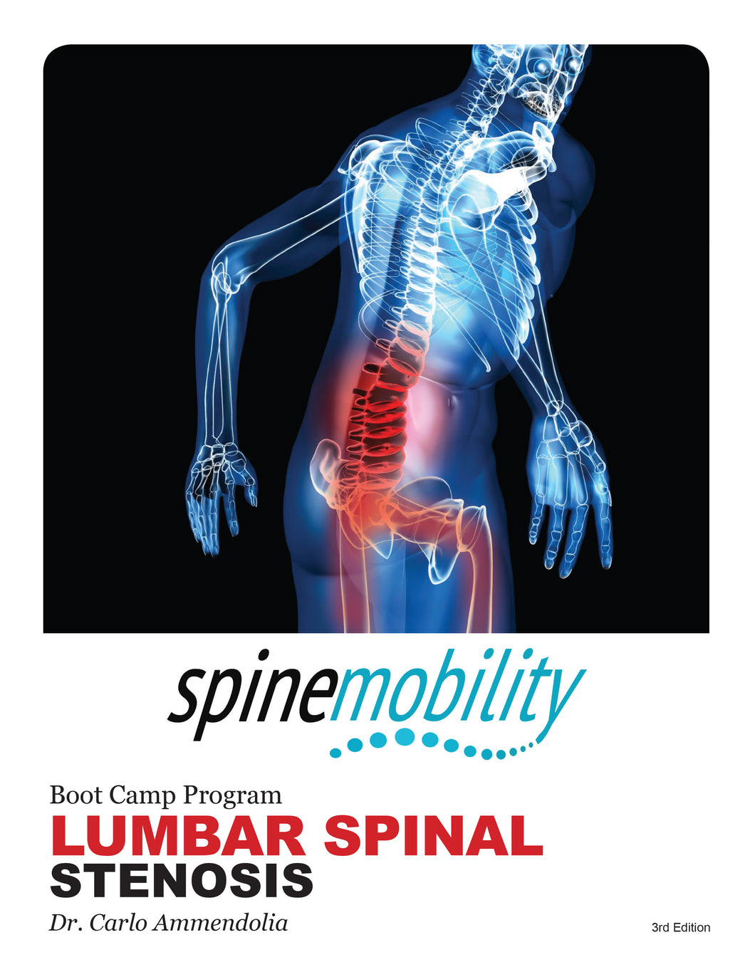 Lumbar Spinal Stenosis Boot Camp Patient Workbook (Public)-Hardcopy