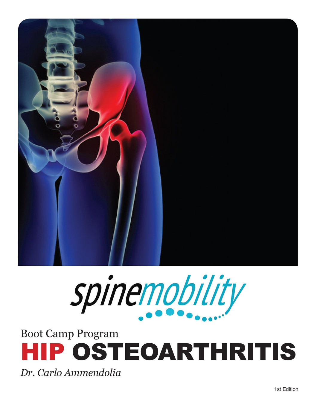 Hip Osteoarthritis Boot Camp Program Patient Workbook Bundle (Includes 5)
